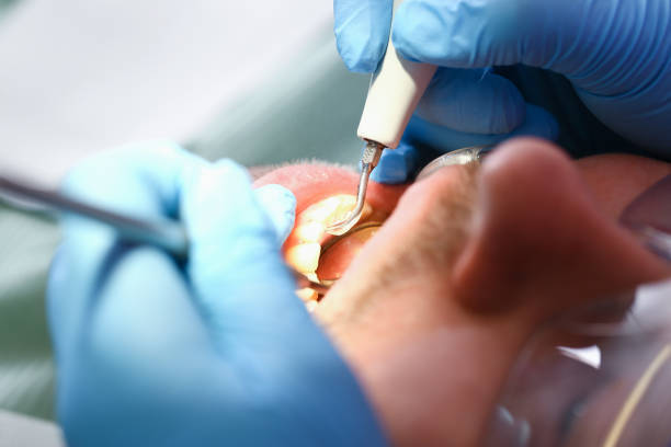 Best Emergency Root Canal Treatment in Raymond, IL
